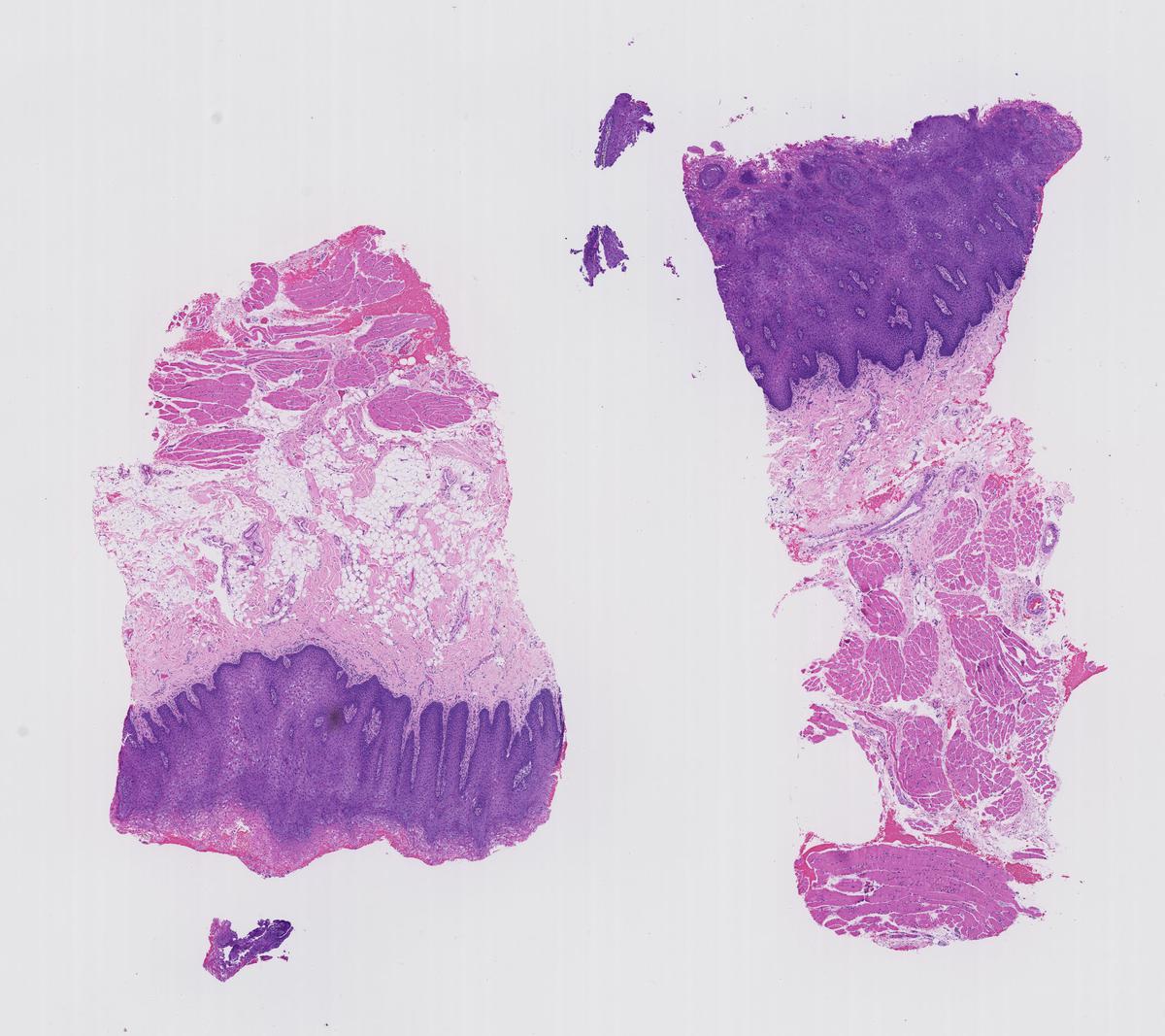 Case 1. A biopsy was performed from the buccal mucosa of a 31yearold female with generalized